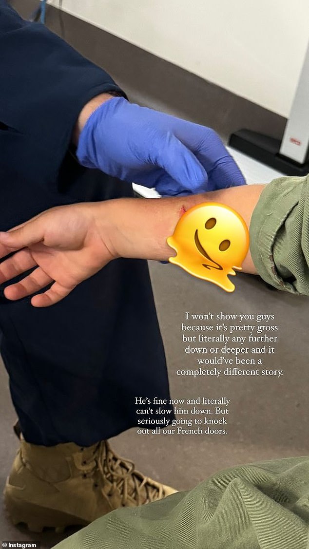 في منشور على Instagram Stories، شارك المؤثر البالغ من العمر 30 عامًا، صورة للطفل الفقير مصابًا بجرح في ذراعه، وتم علاجه في المستشفى.