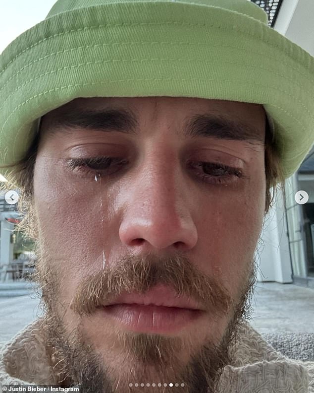 أثار جاستن القلق مؤخرًا عندما نشر عددًا من صور السيلفي له وهو يبكي
